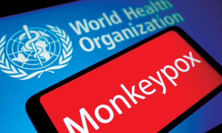 قال خبير بارز في منظمة الصحة العالمية، إن الانتشار غير المسبوق لجدري القردة في الدول المتقدمة قد يكون سببه الاتصال الجنسي غير الآمن في حفلتي