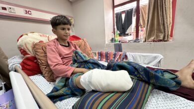 كشفت منظمة دولية إن ما لا يقل عن 10 أطفال يفقدون سيقانهم كل يوم في قطاع غزة الذي يتعرض لهجمات كيان الاحتلال منذ  السابع من أكتوبر الماضي. وأو
